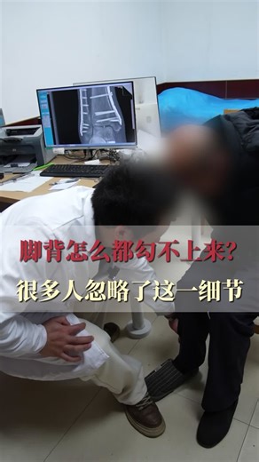 脚背怎么都勾不上来？很多人忽略了这一细节#医学科普 #骨科 #医生