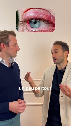 Blépharite : comment s'en débarrasser ? | Dr. Koppe & Dr. Boujnah
