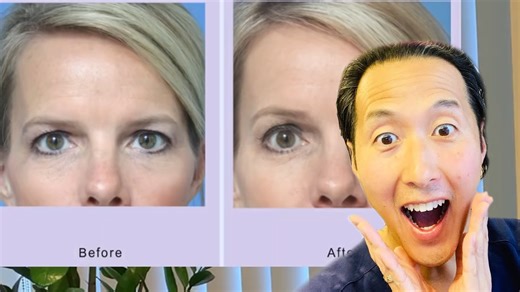 Budget tips to look younger, according to a surgeon