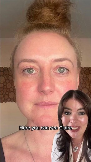 Absolute Collagen before & after 😲