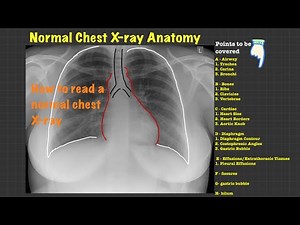 How to read Normal Chest Xray⭐️ Interpretation and Key findings