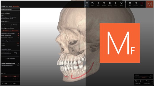 2.5K views · 22 reactions | Discover the new Bone Doctor module in Zirkonzahn.Modifier – for accurate 3D bone segmentation and efficient implant planning. Click here for more information  https://zirkonzahn.com/en/cad-cam-systems/cad-cam-software/zirkonzahn-module/software-modules-cadcam-overview/bone-doctor-software-module | Zirkonzahn Worldwide | Facebook
