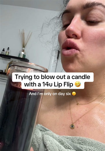14 unit lip flip update #philadelphia #foryou #nursesoftiktok #learnfromme #lipflipresults #lips #funnytiktok