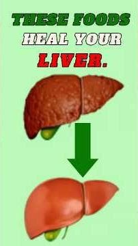 7 Best Foods to Cleanse Your Liver Naturally (Science-Backed). #liverhealth #turmeric #foods