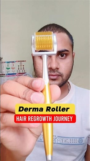 Derma Roller | Micro needling process | Hair Regrowth