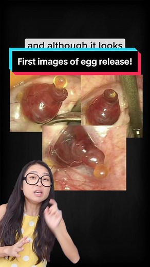 What a happy eggcident~ #ovulation #egg #female #discovery #justkeepthinking #biogirlmj #learnontiktok