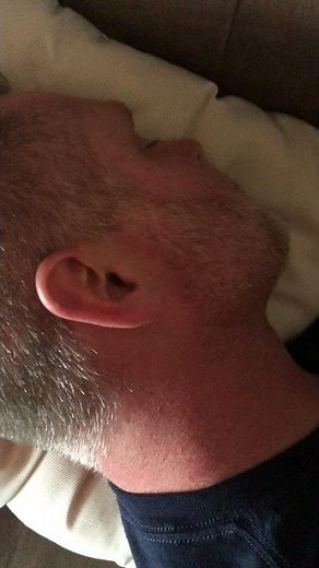 C1 transverse process