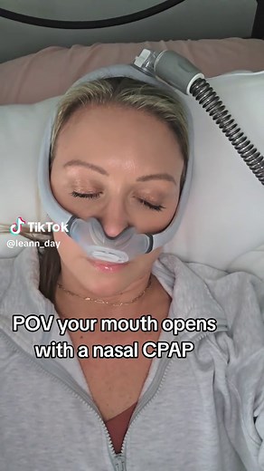 Luchando con el CPAP: el dolor de la boca abierta
