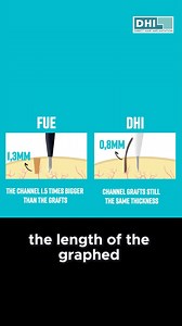 DHI vs. FUE — What Sets Us Apart? Both DHI and FUE are popular hair transplant methods, but the difference lies in precision, technique, and results. At DHI Bangladesh, we go beyond the basics. ✅ No stitches, no scars ✅ No shaving required ✅ Graft survival up to 90% ✅ 100% performed by certified doctors ✅ Natural hairline with maximum density using the DHI Implanter (CHOI Pen) Why settle for less when you can choose DHI – the gold standard in hair restoration? 📍 Visit DHI Bangladesh – A Unit of