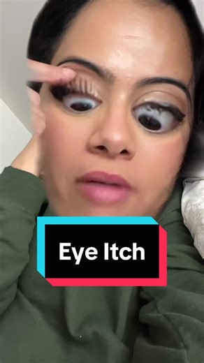 How to Relieve Eye Itch: Tips from an Eye Surgeon