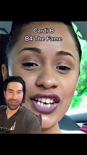 Cardi B Before vs After: Smile Makeover Transformation
