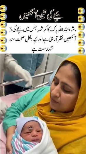 Mysterious Viral Clip of a Baby With “Three Eyes”