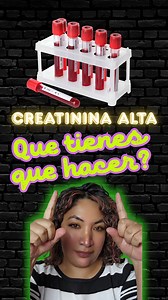 que tienes que hacer si tu creatinina esta alta. el primer paso! #nefrologo #creatinina #insuficienciarenal #saludrenal #creatininaalta | Dra Paola Nefrologa
