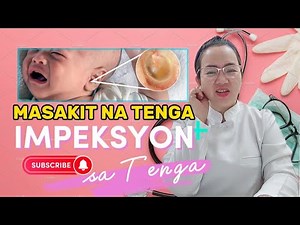 TENGA MASAKIT | IMPEKSYON SA TENGA : SINTOMAS, SANHI, PAGGAMOT, AT PAG-IWAS | MAKATING TENGA