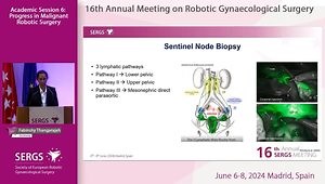How to Deal with Endometrial Cancer Robotically