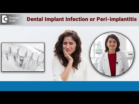 Warning Signs of Infection around Dental Implant | Peri-Implantitis -Dr.Aditi Garg | Doctors’ Circle
