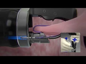 OverStitch™ Cinch Animation