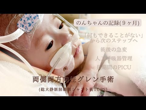 【先天性心疾患】心臓病｜グレン手術｜TCPS手術｜急変｜人工呼吸器管理