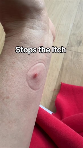Effective Bug Bite Relief Tool