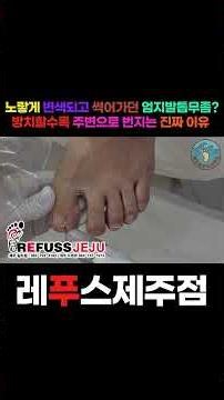"노랗게 변색되고 썩어가던 엄지발톱무좀?! 😱 방치할수록 주변으로 번지는 진짜 이유, 통증 없이 싹 비워내고 3D 와이어로 바른 성장 유도한 정밀 스케일링 전후 현장!