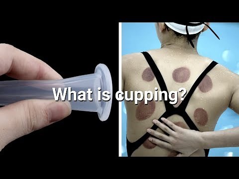What is cupping and how to do it yourself | Silicone cupping set