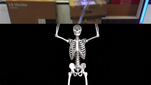 #creatorsearchinsights Dell laptop Screen Damage Replacement with New Screen. #laptopscreen #laptop #CapCut #foryou @Sunrise Computer tec🇧🇹 🇧🇹