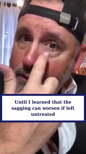 FEG Eye Cream Middle East trên TikTok