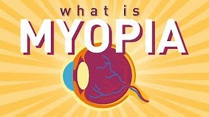 Japan to conduct 1st major survey on myopia among schoolchildren