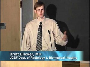 UCSF Radiology: CT Scans for Coronary Artery Disease