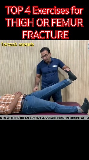 Top 4 exercises are Recommended by orthopaedic surgeon after femur or thigh Bone fracture#fractures