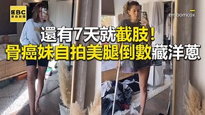 364K views · 8.4K reactions | 大編：看著看著眼眶就紅了QQ 還有7天就截肢！骨癌妹自拍美腿倒數藏洋蔥 影片授權：embomcox/TikTok | 東森新聞 | Facebook