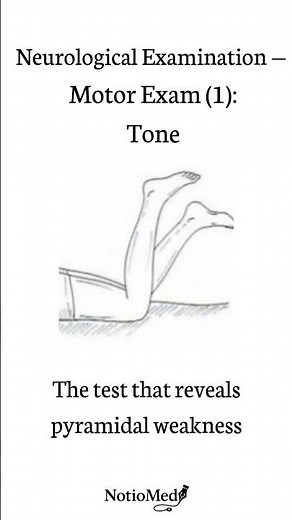 Barré Test Explained (Pronator Drift in #neurology )
