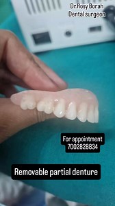 খোলা মেলা নকলি দাঁত//Removable partial denture//drrosyborah//perfect32 dental care,implant & orthodontic centre #viral #reel #highlight #fbpost | DrRosy Borah Chetia