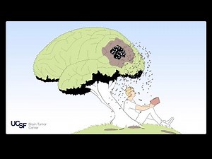 General Wellness Strategies to Boost Your Brain Power | UCSF Brain Tumor Center