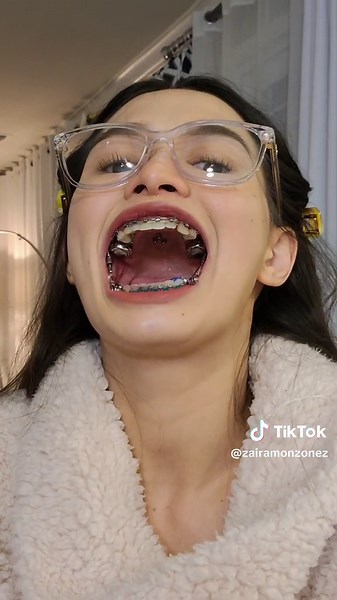 Durex Chewing Gum Long Time Side Effects Explained by Zaira Monzon