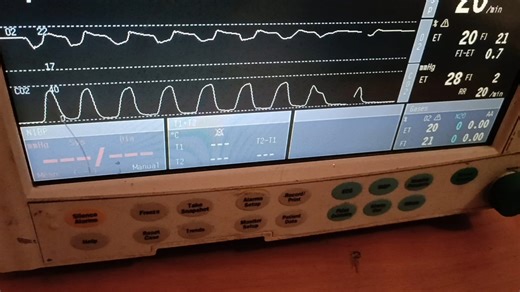 气体监护模块［Flow Paw Vol传感器］［呼末CO2、O2采样］维修