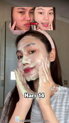 Kulit kasar, penuh komedo, dan pori-pori besar? Pakai sabun cuci muka lumpur dari Korea ini saja sudah cukup! #DiskonAkhirBulan #ForYouBeauty #komando #Jerawat #bekasjerawat LY