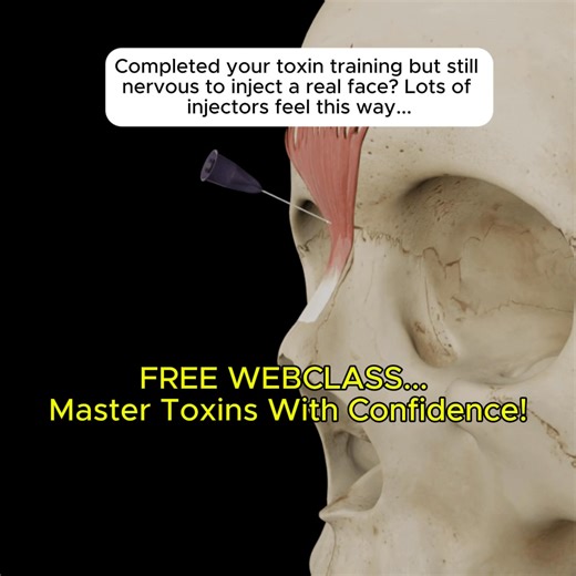 How to Fix a Spock Brow: The 2-Step Solution ⬇️ Early in my career, I gave an older patient a huge Spock brow. I was mortified. A true Spock brow isn't just an over-lifted brow—it involves medial brow ptosis (a drop) paired with lateral brow elevation (a lift). Here's my proven 2-step approach to fix it: ✅ Step 1: Soften the lateral brow with just one unit into the upper lateral frontalis ✅ Step 2: Make sure the brow depressors are relaxed by treating the glabella and procerus Want to create saf