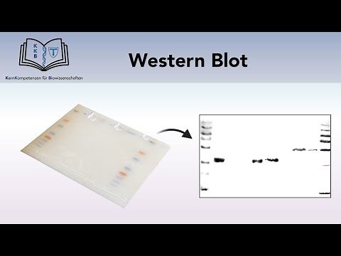 WESTERN BLOT