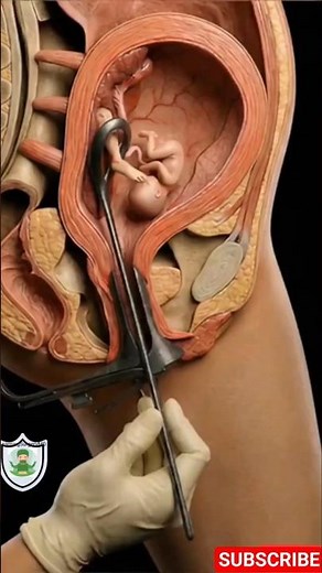 When Your Doctor Recommends a D&C Procedure #gynecology #medical #obgyn