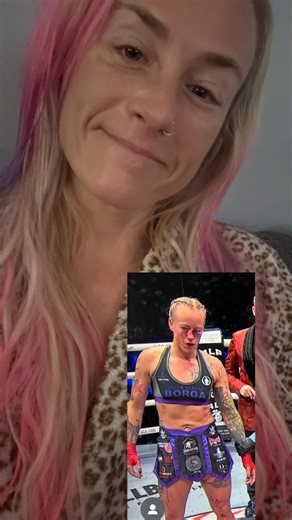 The body is amazing lmao and anyone who has followed me and my career knows my style comes with these outcomes sometimes lol it’s normal for me. However this was more the orbital break than the nose in the fight! I got lucky! I can fight another day. For that I’m truly grateful and can’t wait to get back in there doing what I love. Already back in the offices working on fundamentals! | Jessica Borga