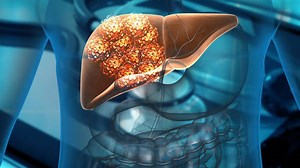 The Symptoms Of Liver Cancer