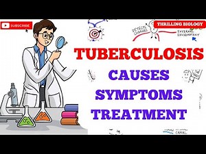 Tuberculosis, Causes, Symptoms, Treatment