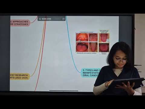 Fungal Dysbiosis and Oral Candidiasis Interkingdom Microbiome Dynamics
