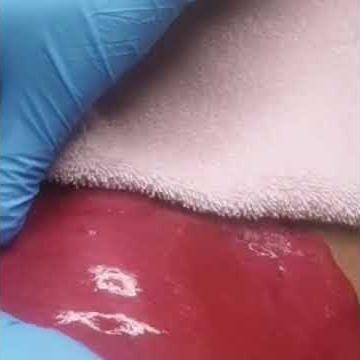 Vajacial perfect results! Check out our newest videos!
