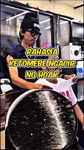 obat ketombe paling gacor 💈✂️🙏 #real #hairstyles #real #fypシ #ketombe | Diksas