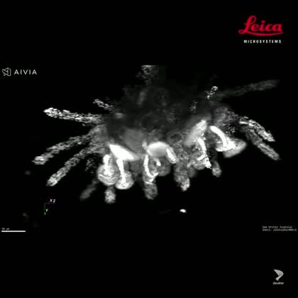 The Viventis Deep multi-view light sheet microscope is the instrument of choice when it comes to long-term 3D imaging of living organisms. Visit our image gallery and discover a wide range of impressive applications including embryos, organoids, whole organisms, and plants ➡️ https://fcld.ly/3r8quk6 The example shows a sea urchin juvenile at 1-week post-metamorphosis. The 3D representation was created with our AI image analysis software Aivia. Localization of gene expression by HCR in situ hybri