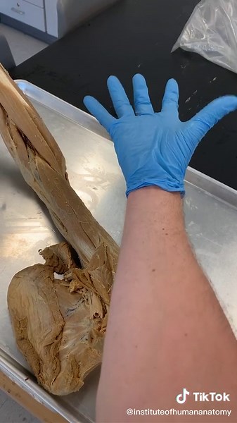 PRONATION vs SUPINATION!! The radius just spins in your forearm, while the ulna stays in place. #learnontiktok #tiktokpartner #education #anatomy