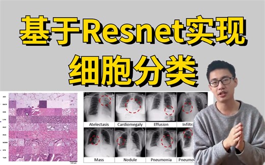 怎样实现细胞分类？AI+医疗保姆级【Resnet实战细胞分类任务】项目实战教程！三个小时带你从入门到成神！收藏起来慢慢学！-医学细胞分类/图像处理/CV