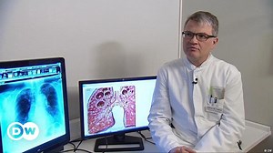 Diagnosing tuberculosis